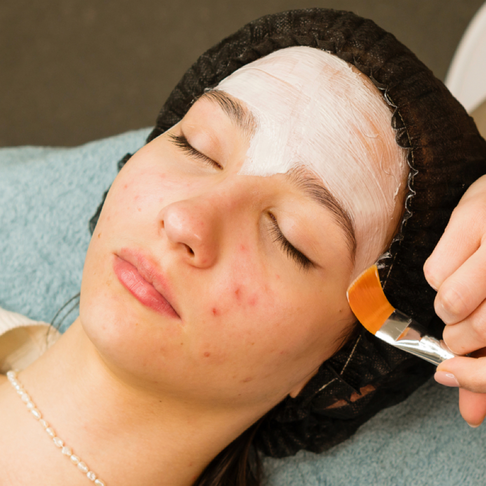 Acne Clearing Facial at The Lash Dream in Waxahachie, TX