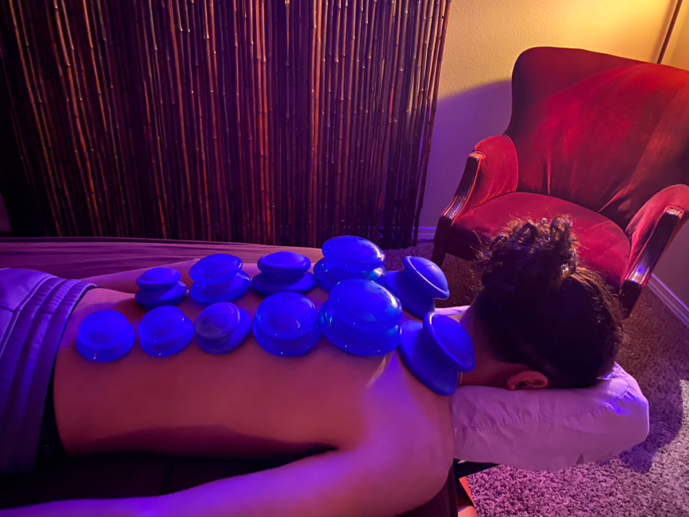 Cupping Therapy