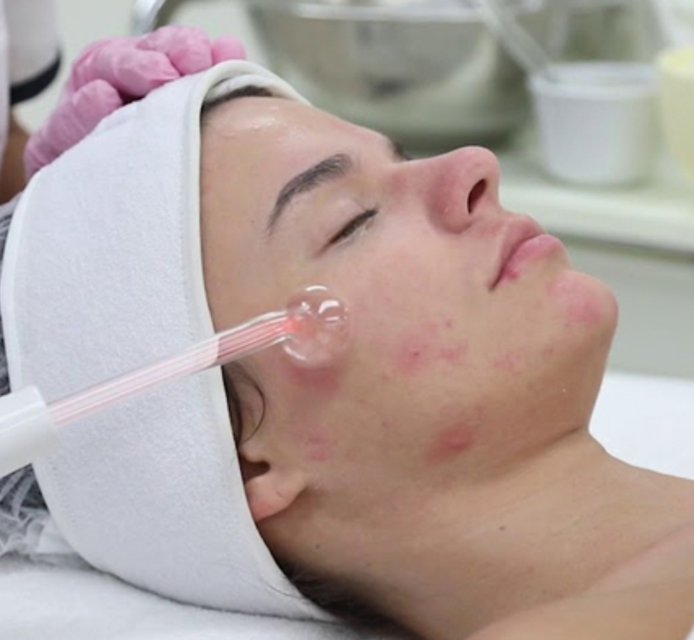 Acne Repair Facial