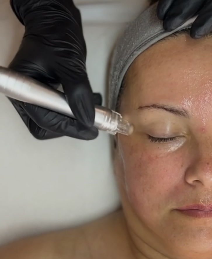 HydroGlow Facial
