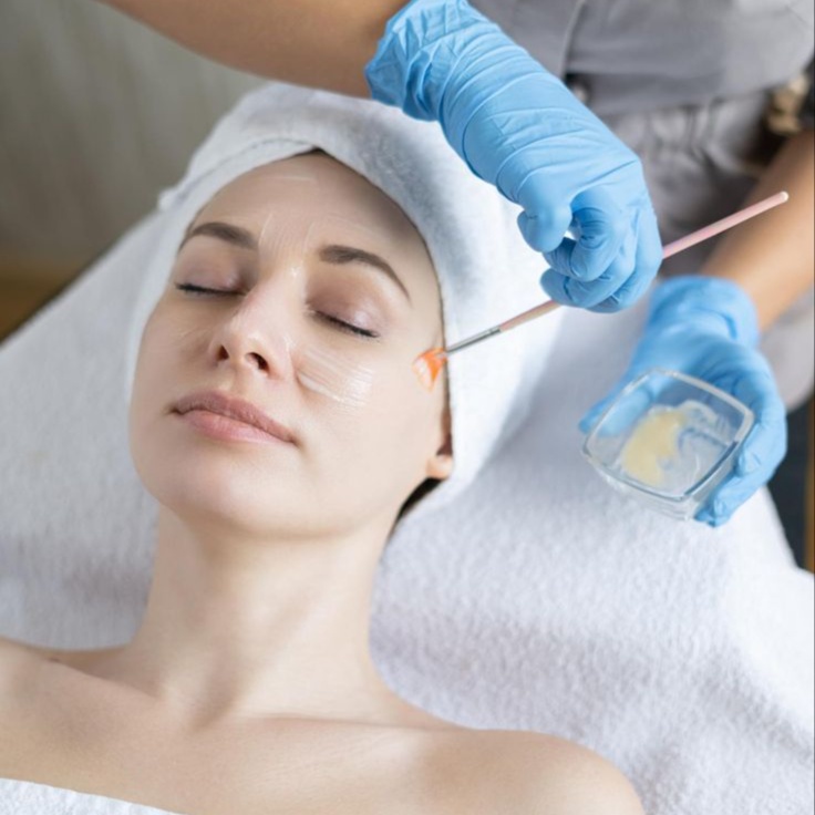Chemical Peel at Wild Rose Med Spa in Chanhassen, MN