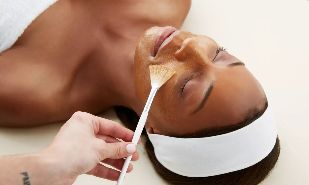 Chemical Peel Facial