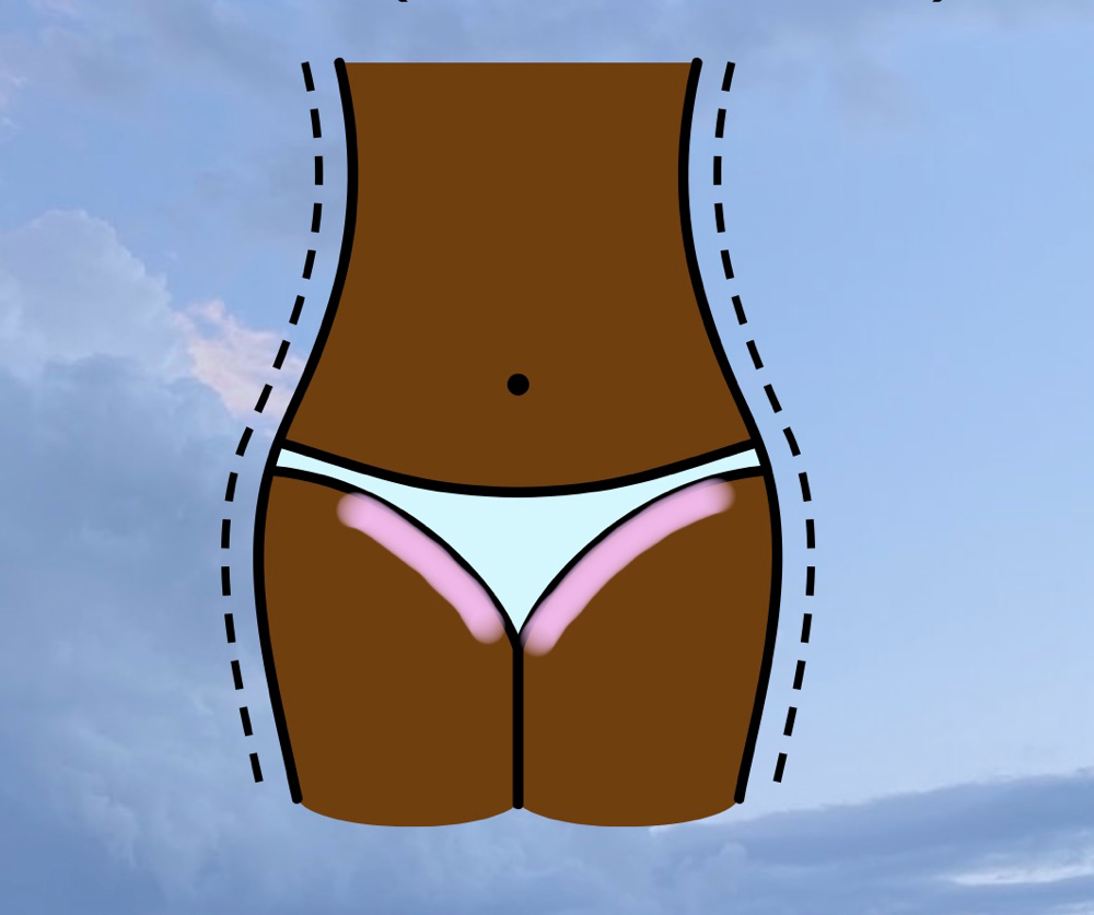 Bikini {Sides Only}