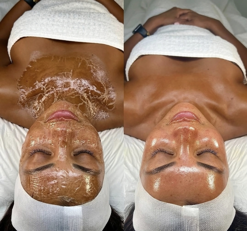 Valley Glow Facial