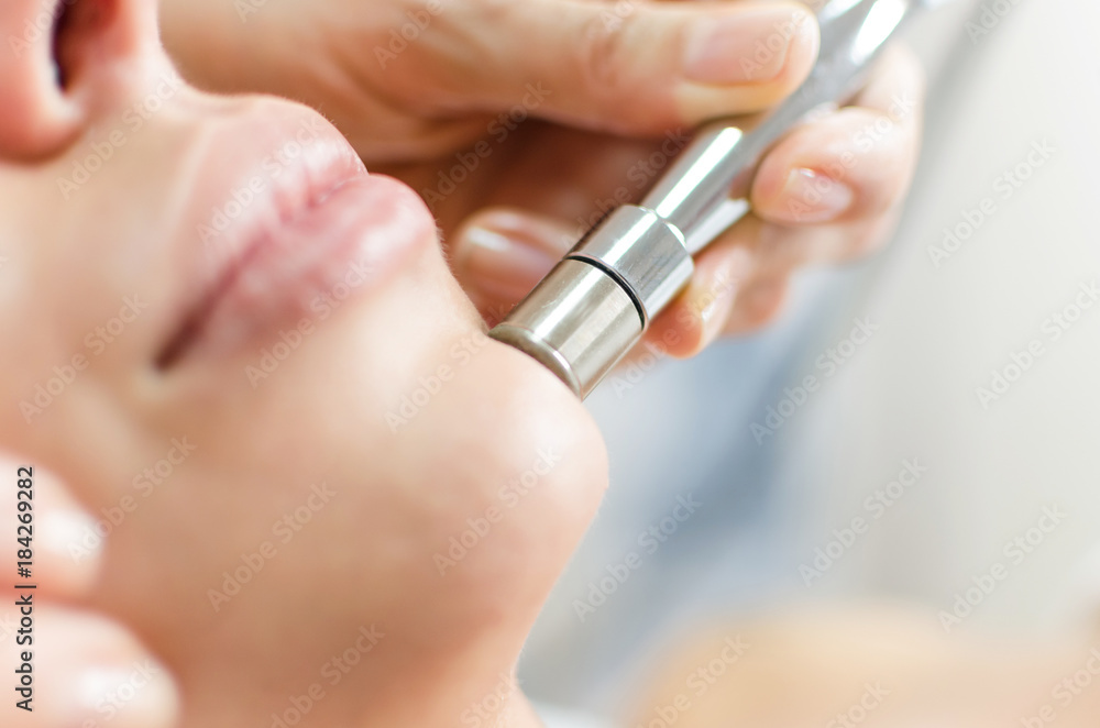 Microdermabrasion