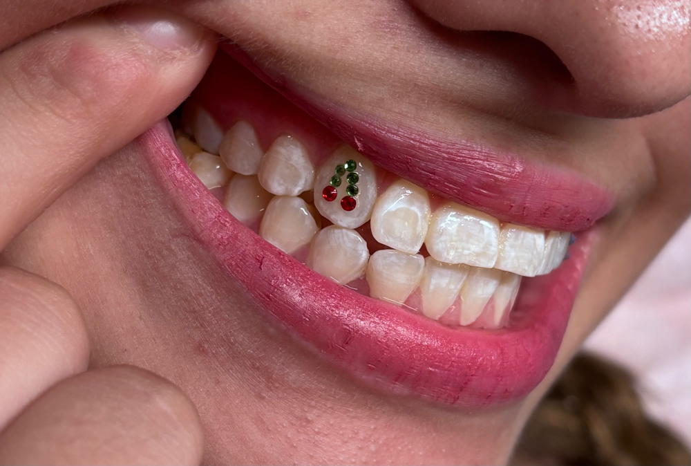 Bright Babe Tooth Gems at Bright Babe Studio in Alice, TX