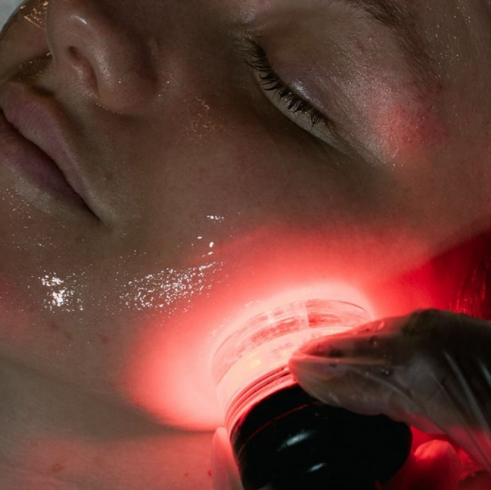 VO Snatched Jawline Sculpt at V/O Aesthetics in Pearland TX, TX