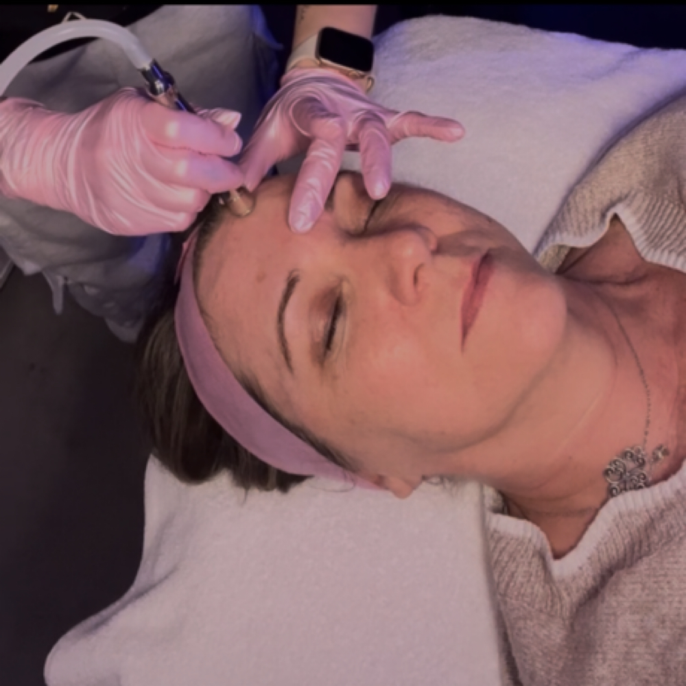 Surface Reset Treatment at Love Yourself By Jeni in Kingwood, TX
