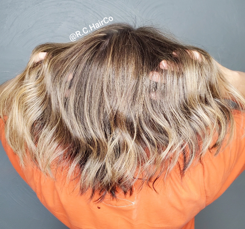 extension removal