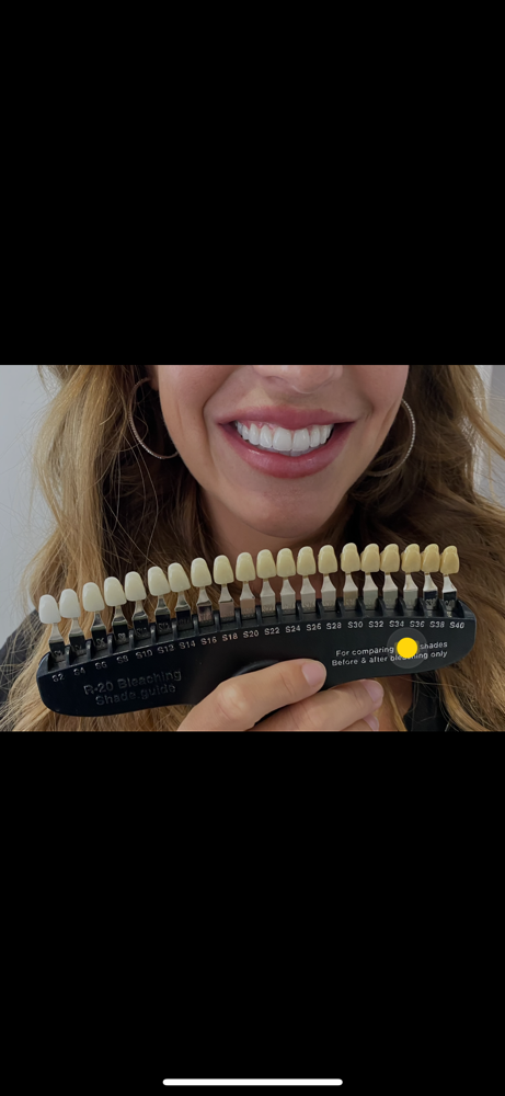 LED Teeth Whitening