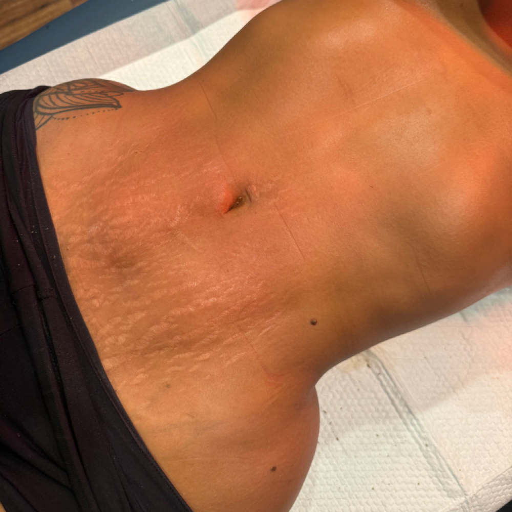 Post-Op Lymphatic Massage Express at E Rose Health Wellness Holistic Therapy in Southfield, MI