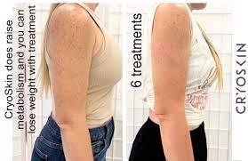 Body- Neveskin  Body 7 Pack