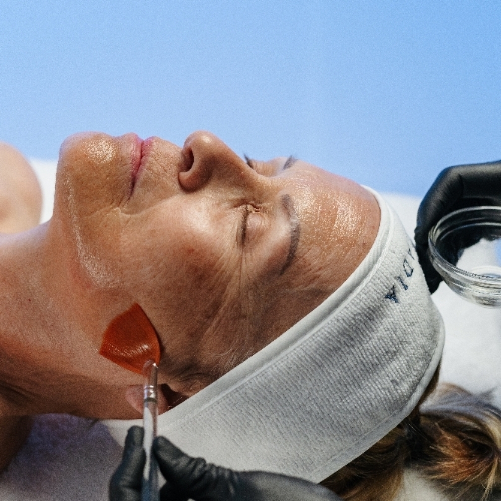 SWiCH™ Dermal Rejuvenation at Dari Esthetics in New York, NY