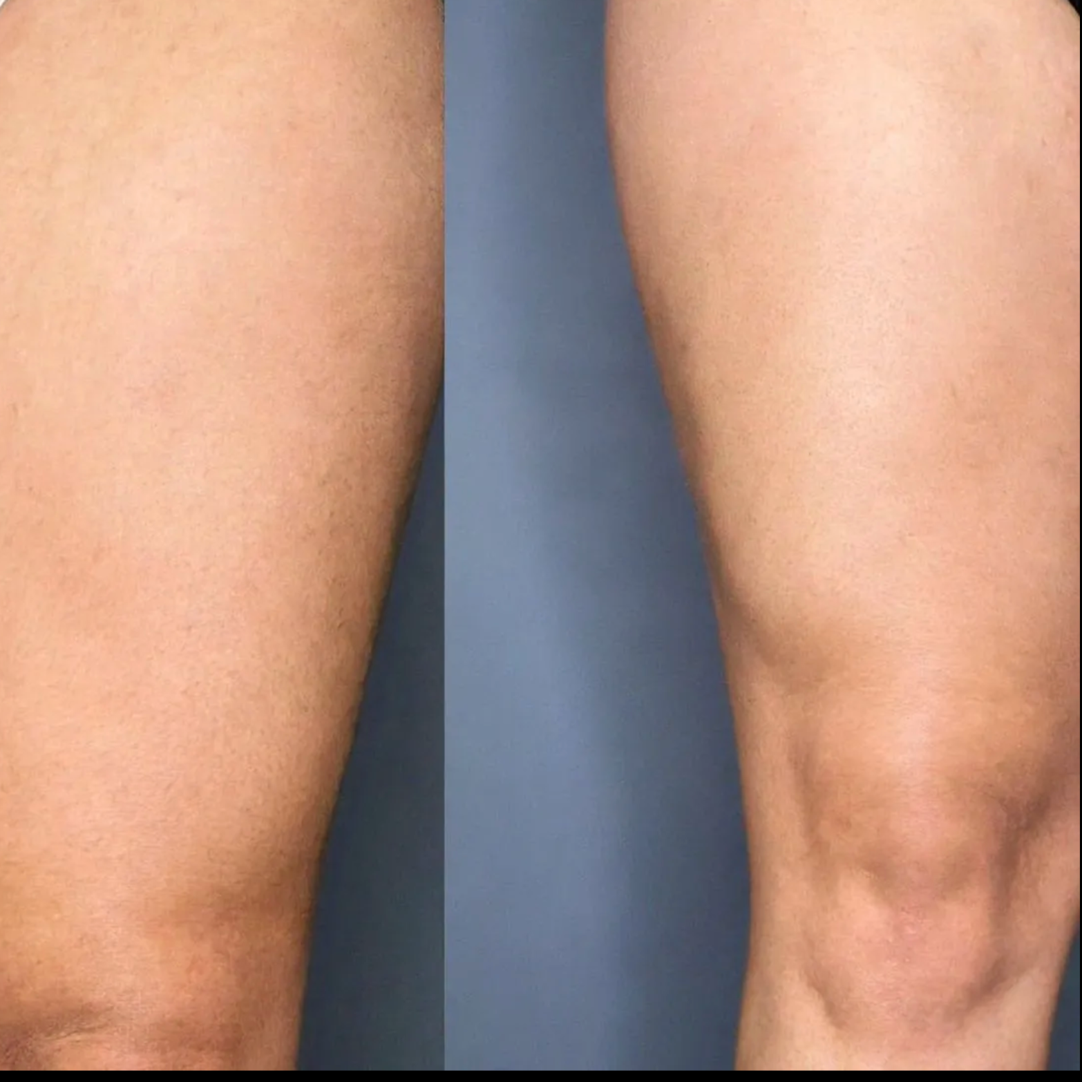 Full Leg Wax at Sassy B Salon & Spa, Fire Pit Tattoos & Beyond the Lines in East Bank, WV