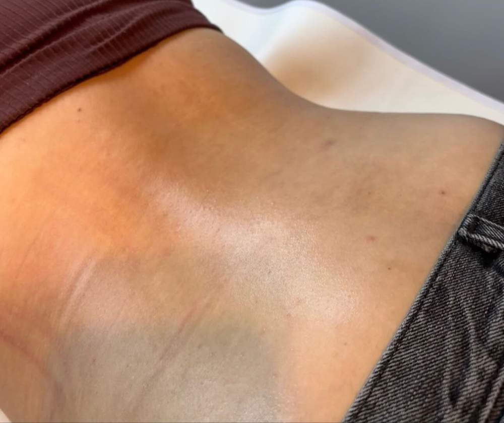 Lower Back at Complexion LA in Los Angeles, CA