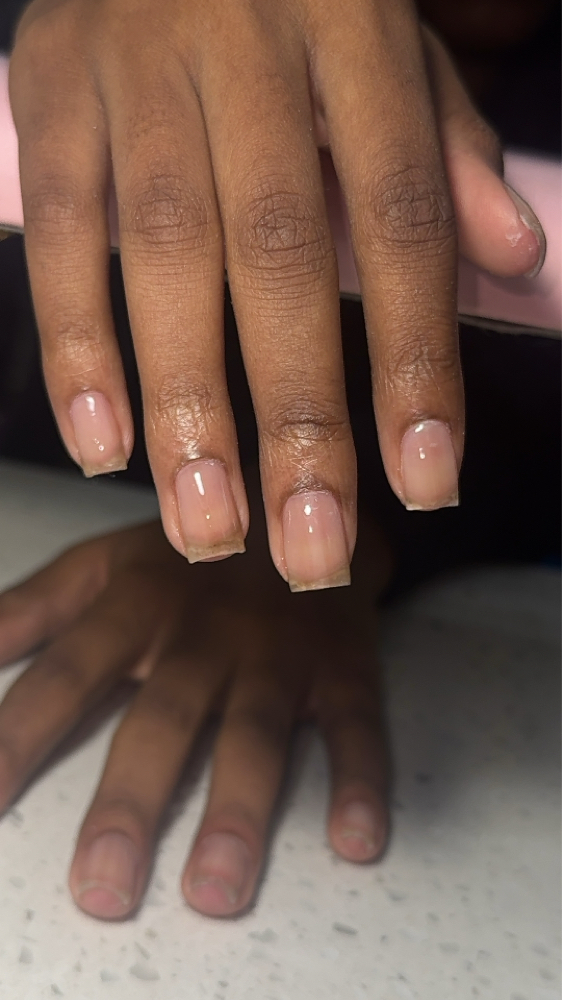 Full Set - Clear Acrylic