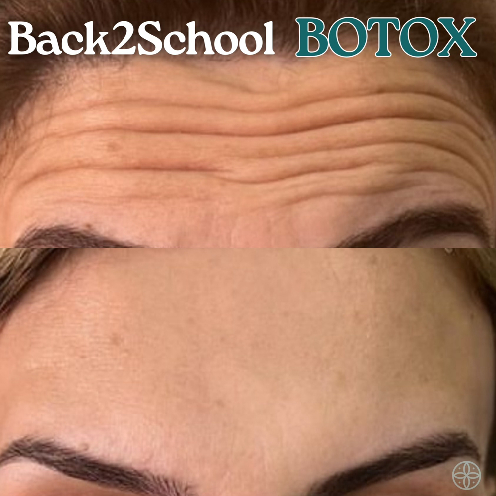 Neurotoxins