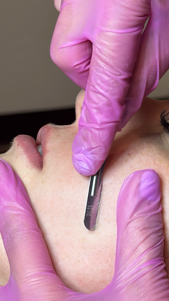 Dermaplane Facial