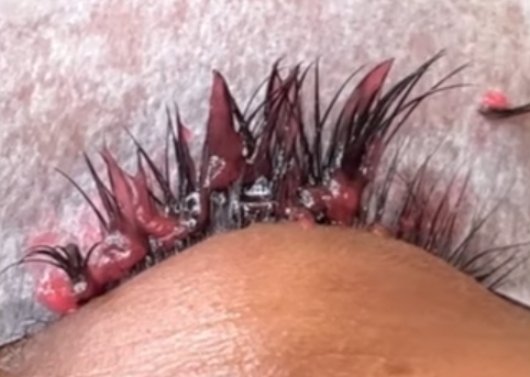 LASH REMOVAL