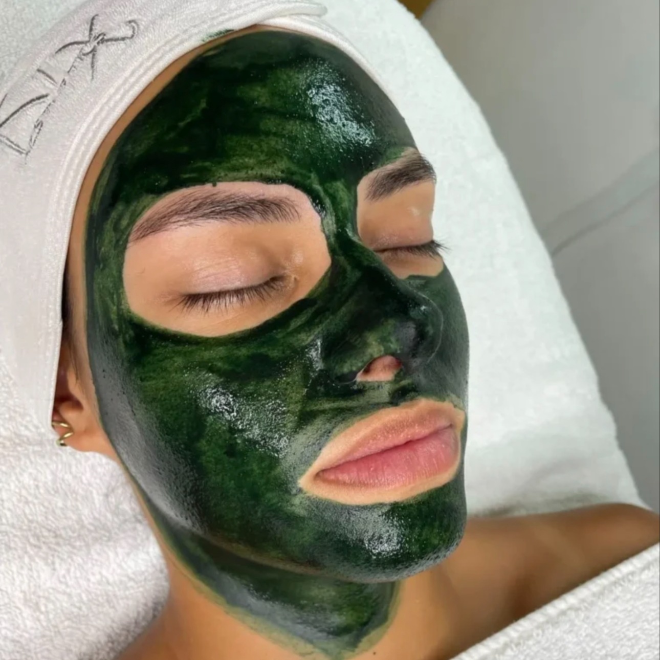 KrX Green Sea Peel at Skin Solutions in Bel Air, MD