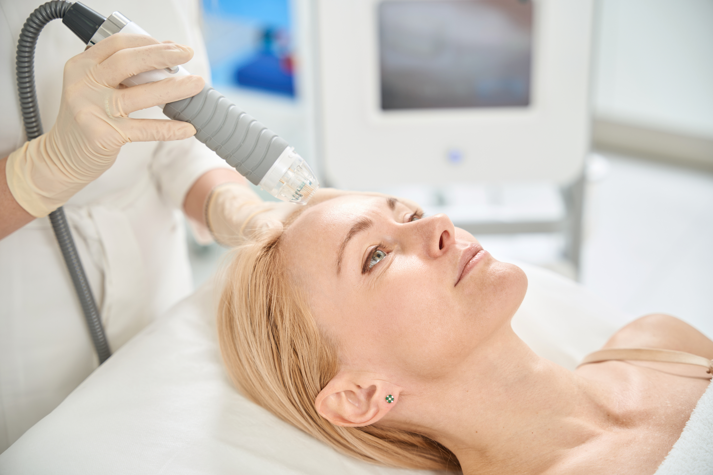 RF Microneedling (Face & Body)