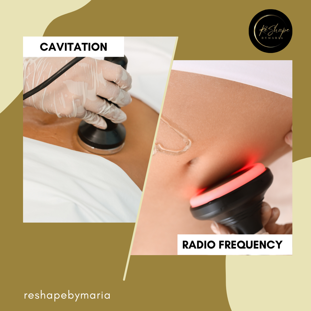 Cavitation With Radio Frequency