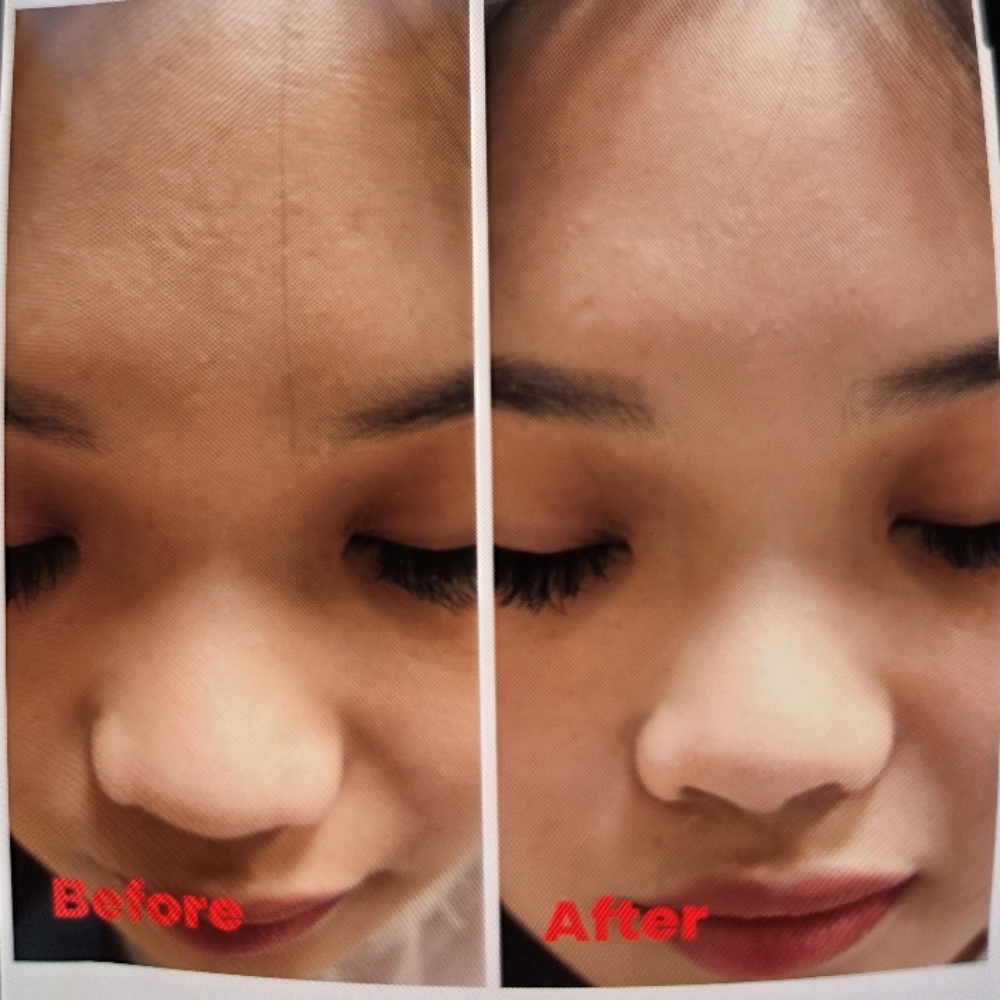 Enzyme Glow Facial at Sun Skincare LLC in Scottsdale, AZ