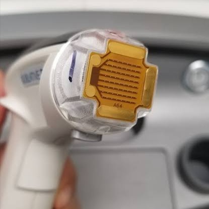 Candela RF Sublative at Illumina Aesthetics and Laser in Palm Beach Gardens, FL