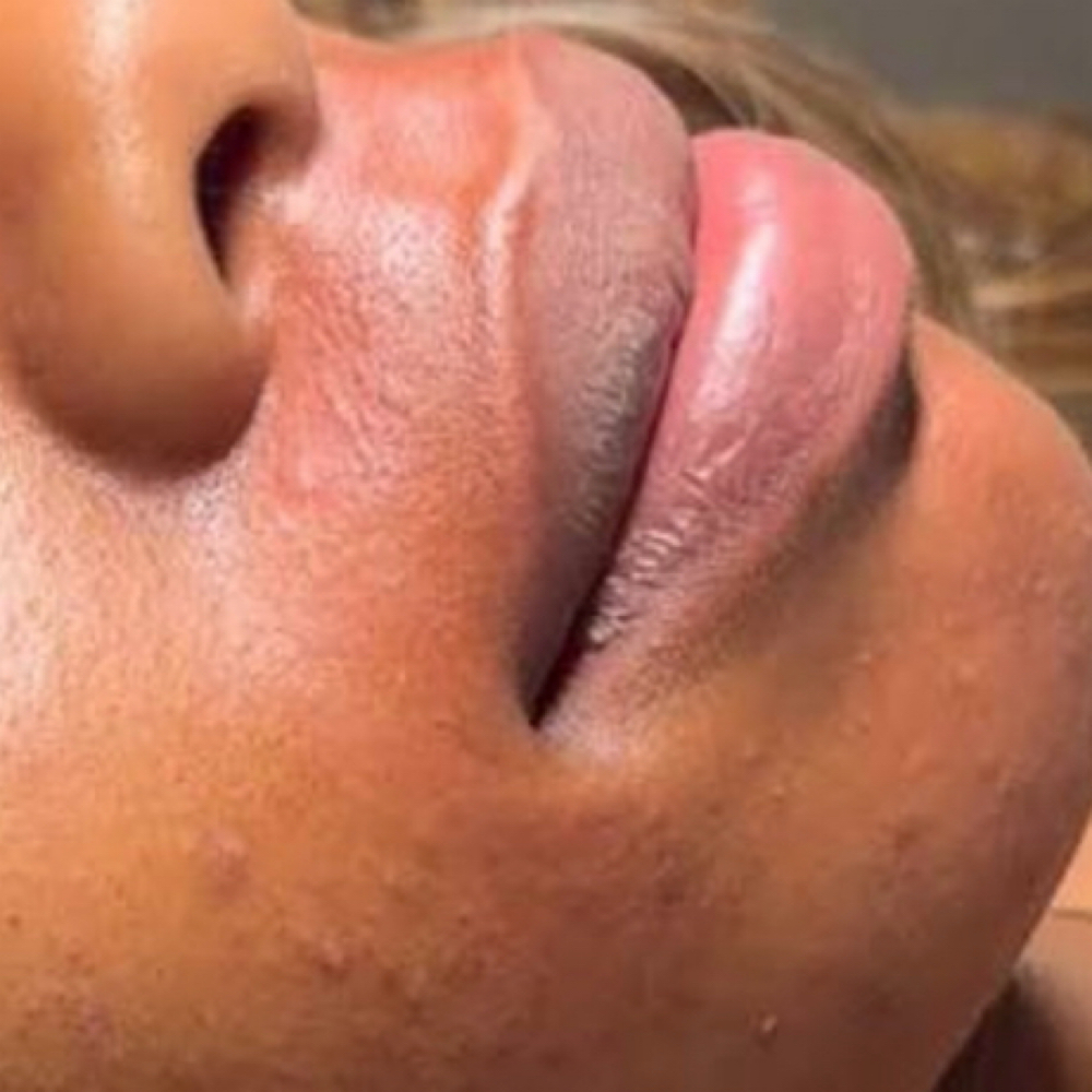 Lip or Chin Wax at Bare Beauty Esthetics in Oklahoma City, OK