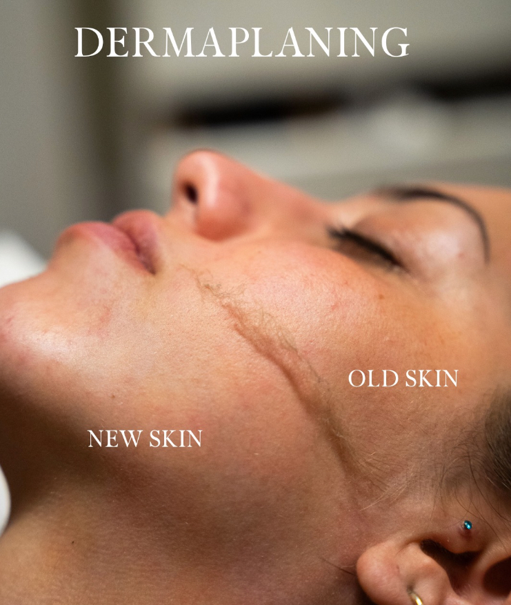 DERMALPLANNING at Faces by DeAngela in New Brockton, AL