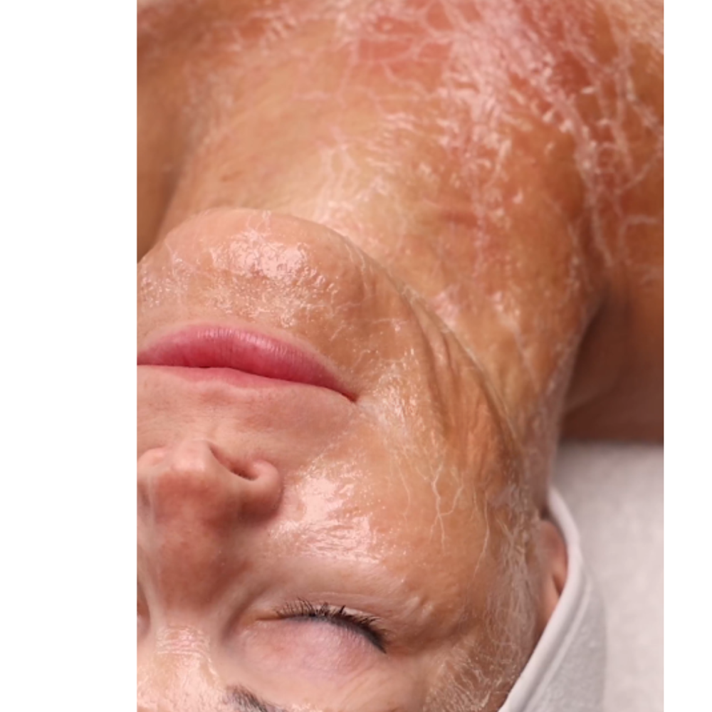 Beyond Botox