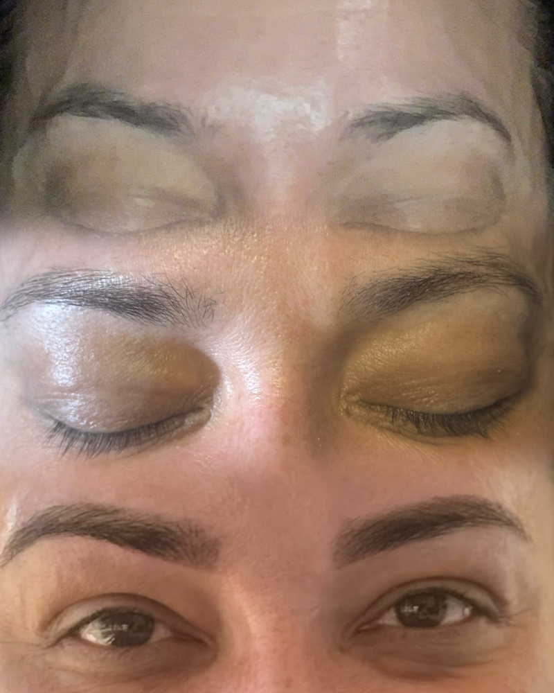 Eyebrow Enhancements