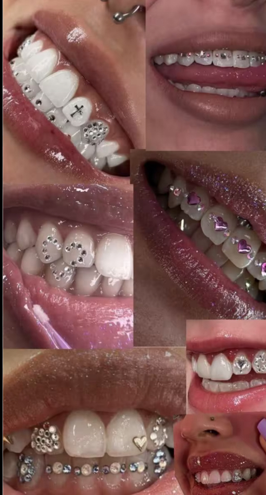 Tooth Gems
