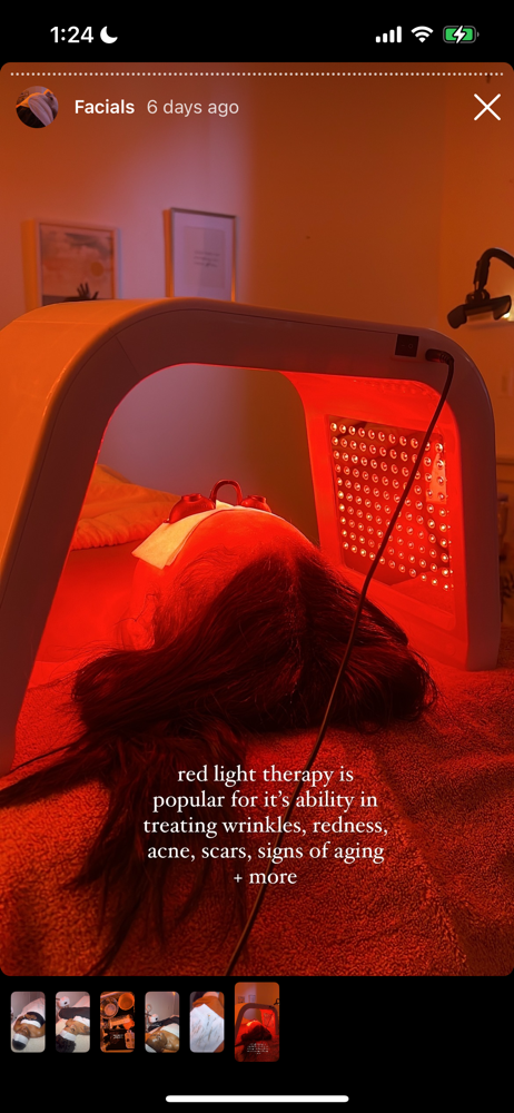 UltraSound & LED Therapy | Add On