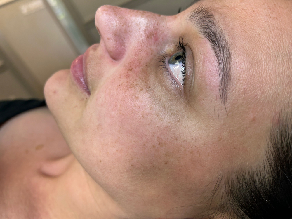 Lash Lift
