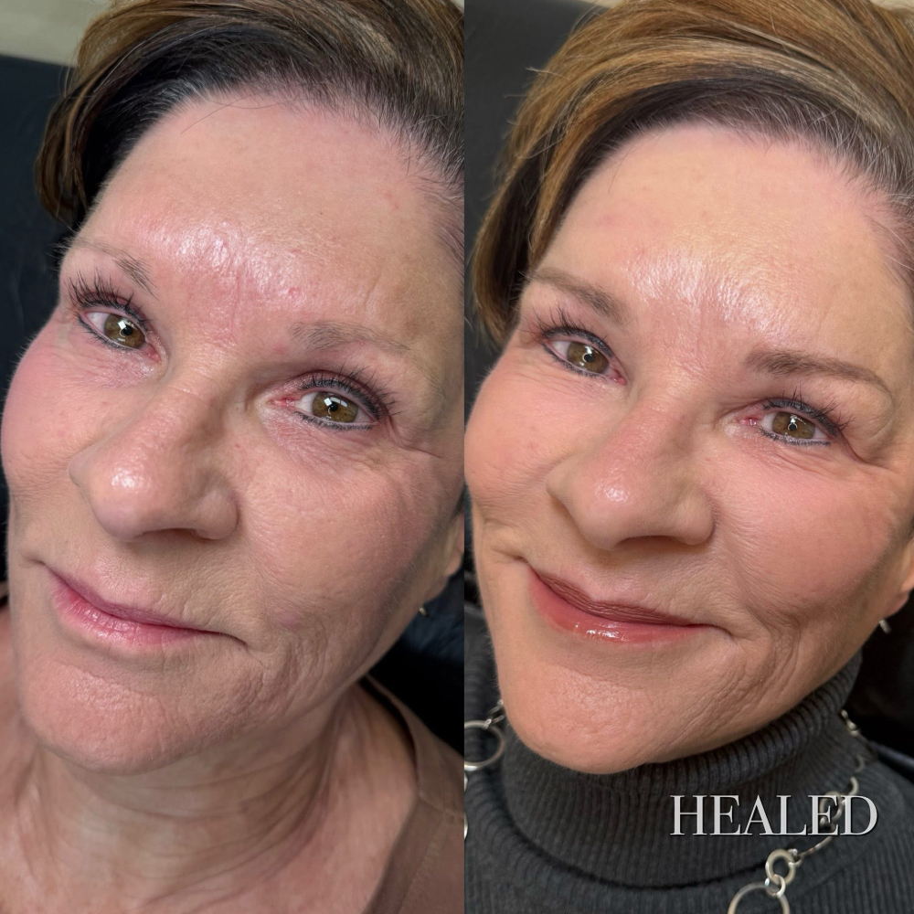 Nano Fusion Brows 6-8 Week Touch Up at Aesthetic Beauty Bar LLC in West Chester, OH