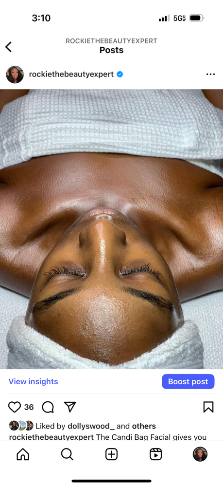 Microdermabrasion Facial