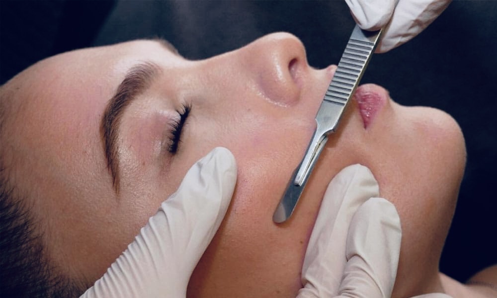 Dermaplane Facial