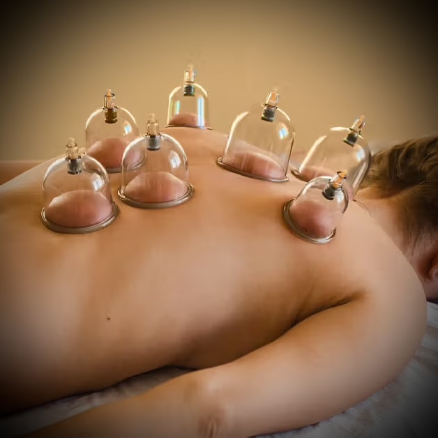 Cupping therapy