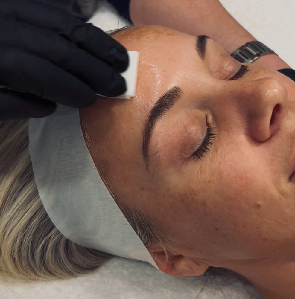VI Peel Precision + Peptides
