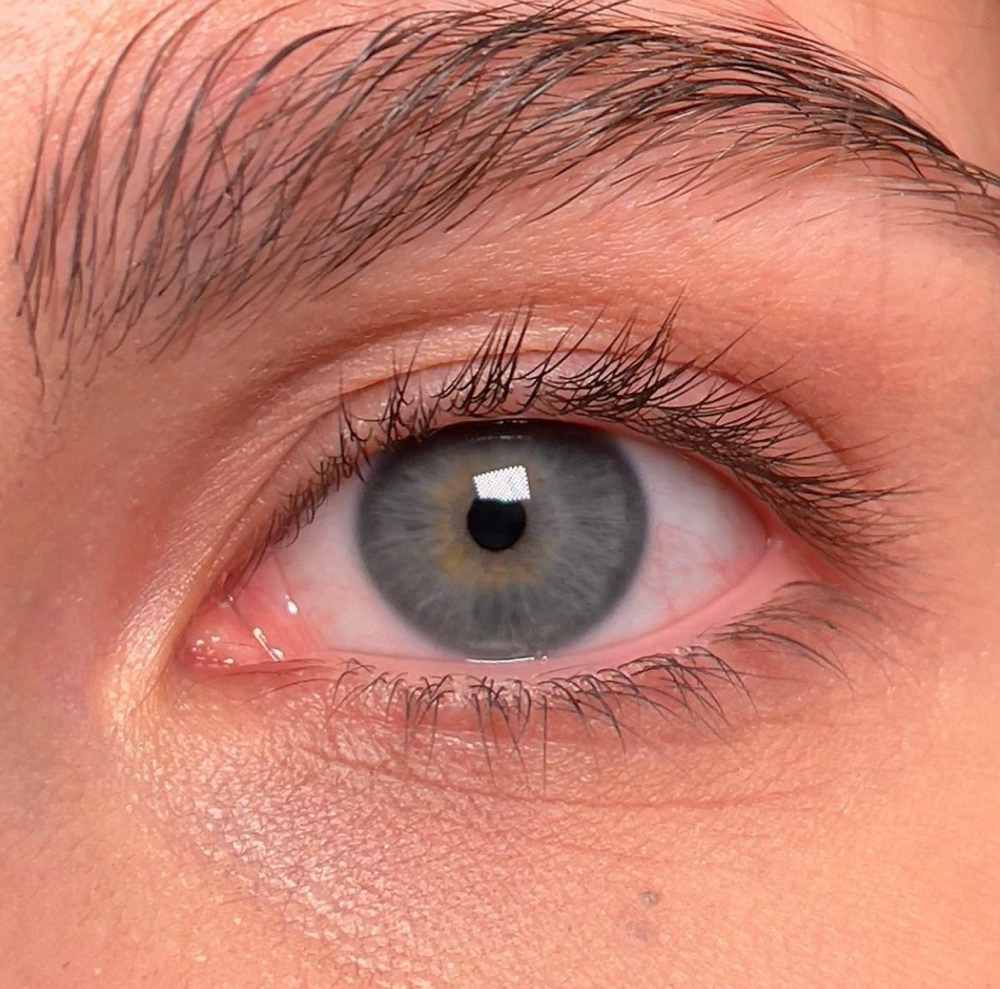 Lash Removal