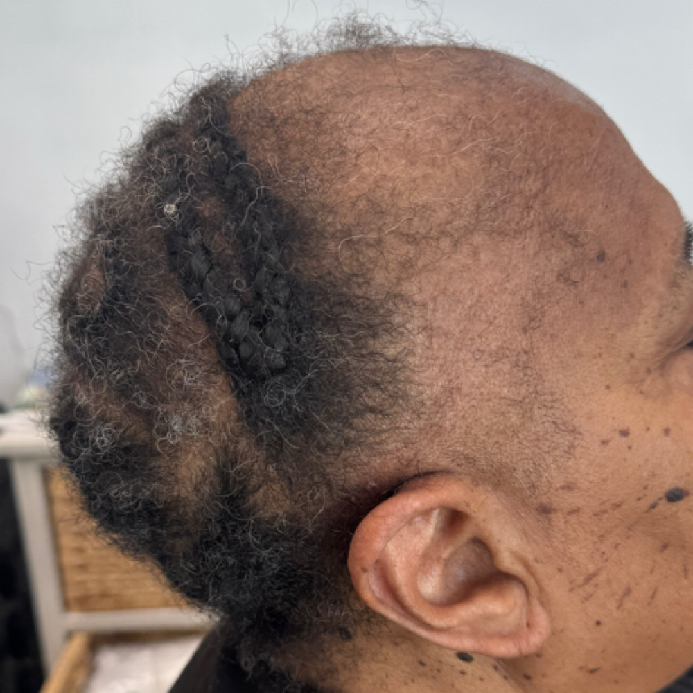 Hair Loss Consultation at Hairvolutions in Gilbert, AZ