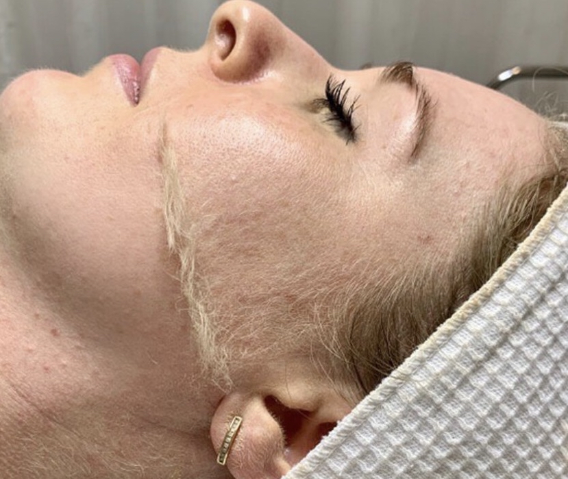 Glass Skin Facial