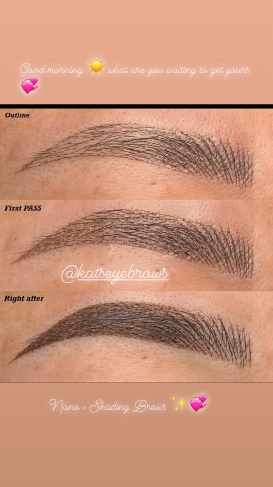 9-27 WEEK BROW TOUCH-UP PROCEDURE
