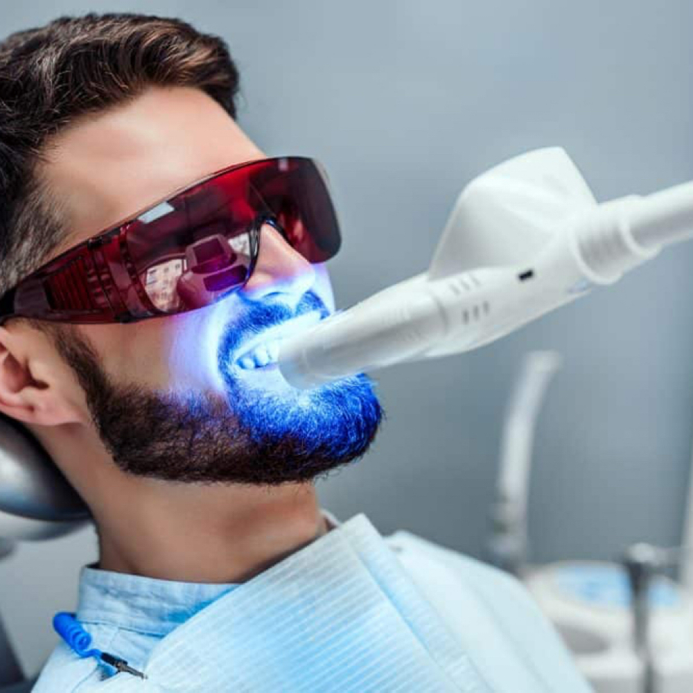 Teeth Whitening at In The Chair With Tiffany in Indian Wells, CA