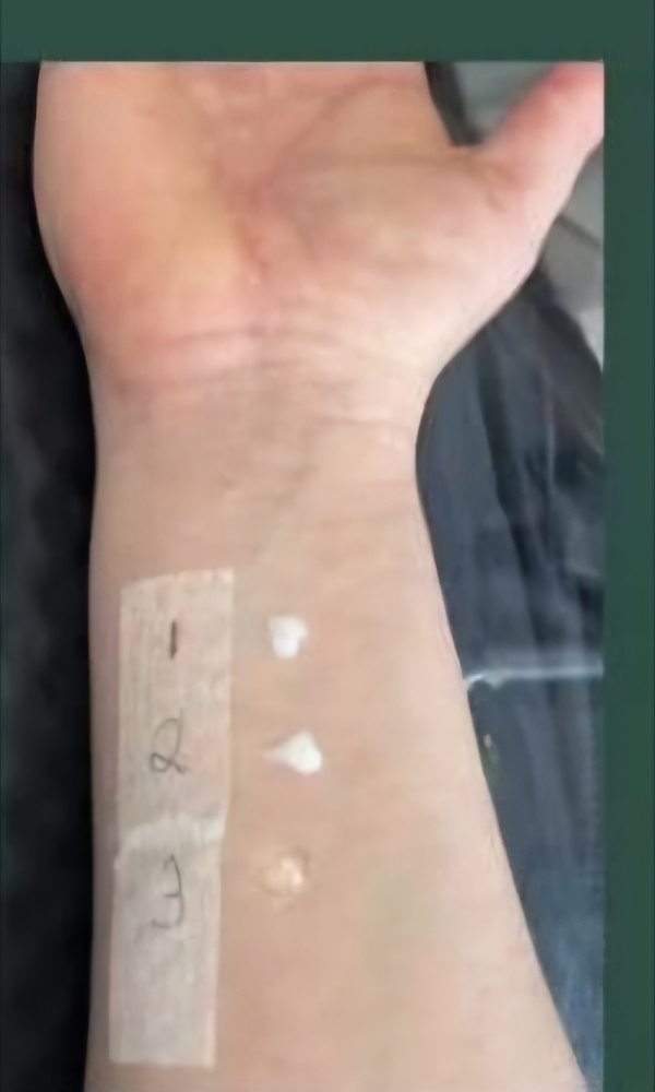 Patch Test Lash Lift Or Lamination