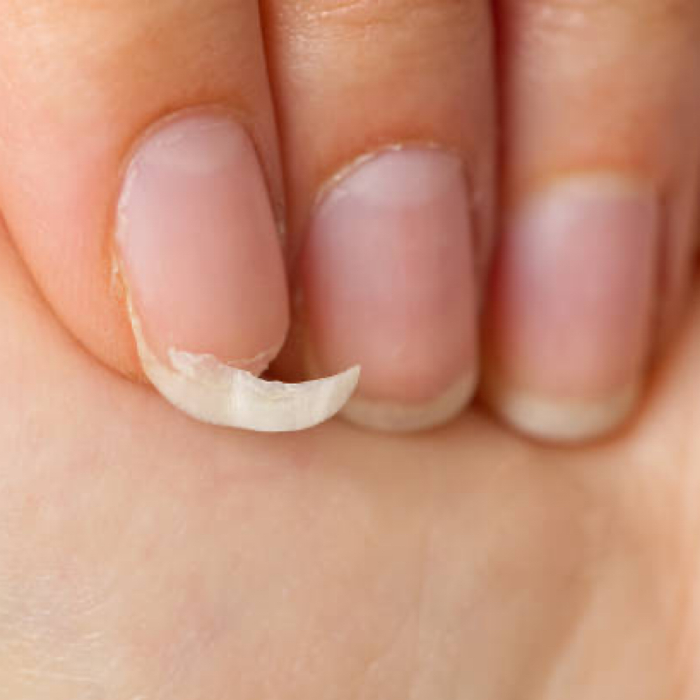 Nail Repair at Kreepy Klaws in nashville, TN