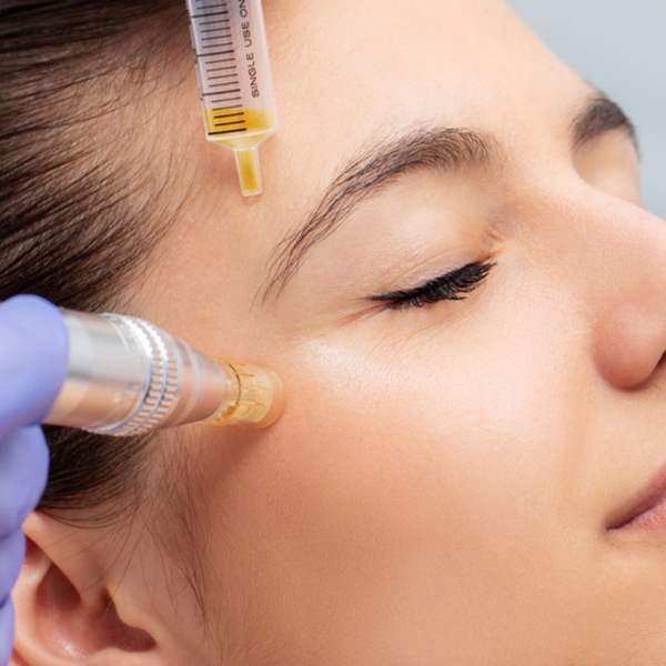 PRP Skin Regeneration Facial at Haus of Glam by Karina J in Haverhill, FL