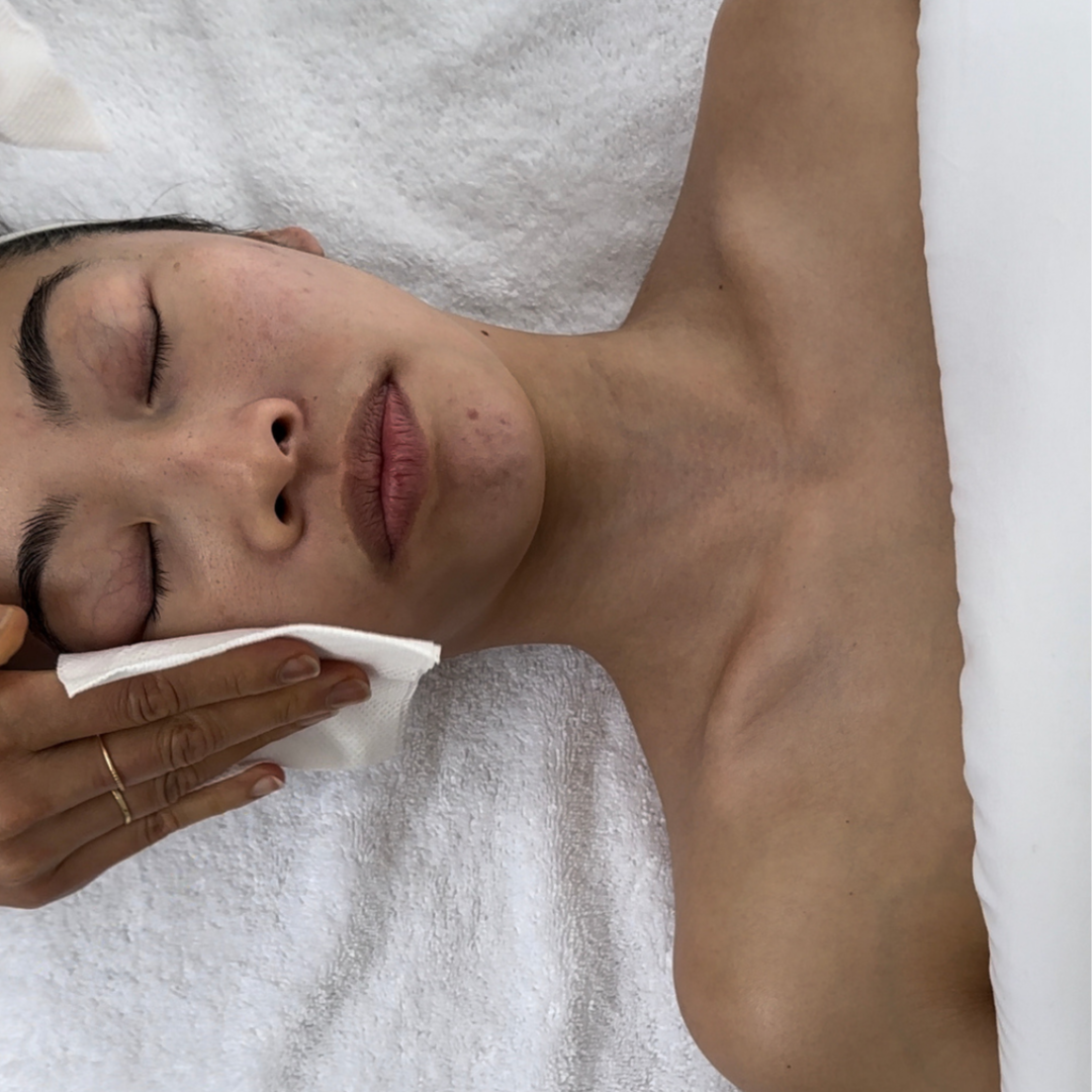 nano infusion single at Golden Root Esthetics in Johnson, TN