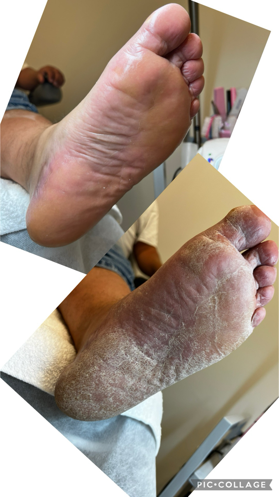 SMART PEDICURE